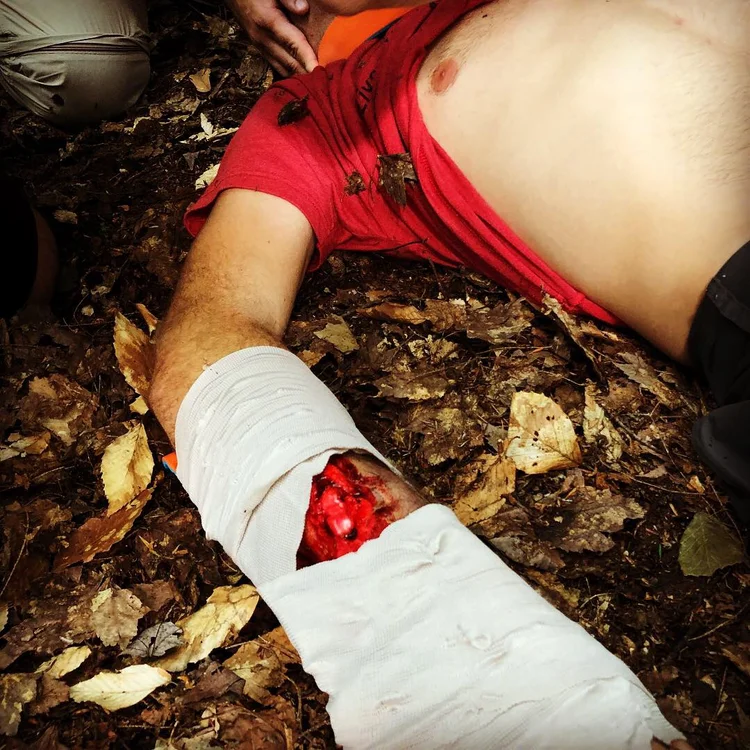 Advanced Wilderness Life Support (AWLS®) · Photo 11